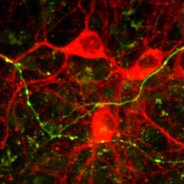 3.בתמונה רואים תאי מוח הגדלים בתרבית וכן את שלוחות התאים היוצרות חיבוריות מורכבת ביניהם.